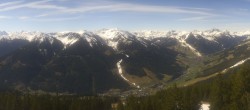 Archiv Foto Webcam Saalbach-Hinterglemm: Kohlmais 09:00