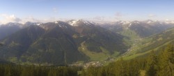 Archiv Foto Webcam Saalbach-Hinterglemm: Kohlmais 07:00