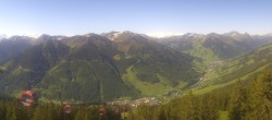 Archiv Foto Webcam Saalbach-Hinterglemm: Kohlmais 07:00