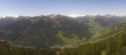 Archiv Foto Webcam Saalbach-Hinterglemm: Kohlmais 09:00