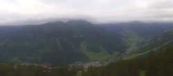 Archived image Webcam Kohlmais (Saalbach-Hinterglemm) 11:00