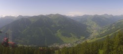 Archiv Foto Webcam Saalbach-Hinterglemm: Kohlmais 09:00