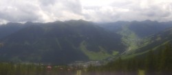 Archiv Foto Webcam Saalbach-Hinterglemm: Kohlmais 13:00