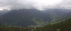 Archiv Foto Webcam Saalbach-Hinterglemm: Kohlmais 11:00