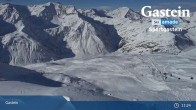 Archiv Foto Webcam Bad Gastein - Sportgastein - Kreuzkogel 10:00