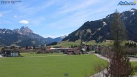 Archived image Webcam Ski Resort Schattwald Zöblen 06:00