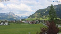 Archived image Webcam Ski Resort Schattwald Zöblen 15:00