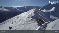 Archiv Foto Webcam Stubnerkogel Bergstation Süd 10:00