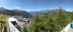 Archived image Webcam Bergbahnen See in Tyrol - Medrig Center 11:00