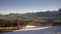 Archiv Foto Webcam Ausblick Mittelstation Hörnerbahn 10:00