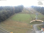 Archiv Foto Webcam Bikepark Winterberg am Erlebnisberg Kappe 10:00
