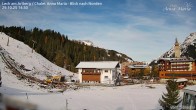 Archiv Foto Webcam Schlegelkopfareal, Lech 13:00