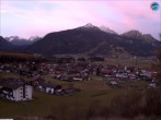 Archiv Foto Webcam Sonnenhang Sessellift Ehrwald 06:00