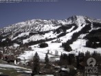 Archiv Foto Webcam Sicht vom Kinderhotel Oberjoch aus auf das Skigebiet gegenüber 10:00