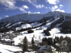 Archiv Foto Webcam Sicht vom Kinderhotel Oberjoch aus auf das Skigebiet gegenüber 11:00