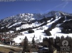 Archiv Foto Webcam Sicht vom Kinderhotel Oberjoch aus auf das Skigebiet gegenüber 13:00