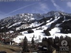 Archiv Foto Webcam Sicht vom Kinderhotel Oberjoch aus auf das Skigebiet gegenüber 13:00