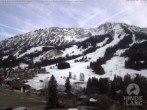 Archiv Foto Webcam Sicht vom Kinderhotel Oberjoch aus auf das Skigebiet gegenüber 15:00