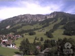 Archiv Foto Webcam Sicht vom Kinderhotel Oberjoch aus auf das Skigebiet gegenüber 15:00