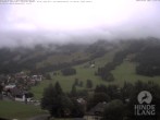 Archiv Foto Webcam Sicht vom Kinderhotel Oberjoch aus auf das Skigebiet gegenüber 10:00