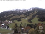Archiv Foto Webcam Sicht vom Kinderhotel Oberjoch aus auf das Skigebiet gegenüber 15:00