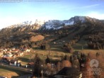 Archiv Foto Webcam Sicht vom Kinderhotel Oberjoch aus auf das Skigebiet gegenüber 15:00