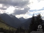 Archived image Webcam Kids hotel Oberjoch: view at the nature reseve "Allgäuer Hochalpen" 13:00