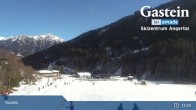 Archiv Foto Webcam Gasteinertal - Skizentrum Angertal 10:00