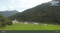 Archiv Foto Webcam Gasteinertal - Skizentrum Angertal 10:00