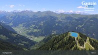 Archiv Foto Webcam Dorfgastein - Fulseck 12:00