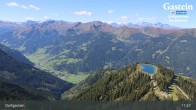 Archiv Foto Webcam Dorfgastein - Fulseck 10:00