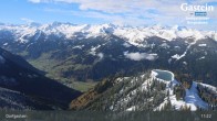 Archiv Foto Webcam Dorfgastein - Fulseck 10:00